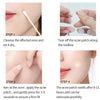 Invisible Acne Patch (72 Pcs)